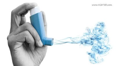 1 راه حل اساسی کنترل و پیشگیری از آسم